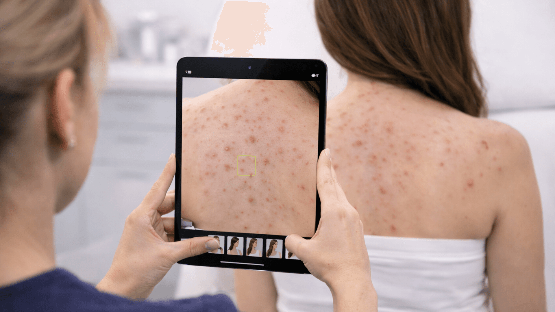 ImageAssist used for Dermatology